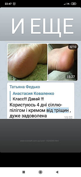 Крем від тріщин на ногах