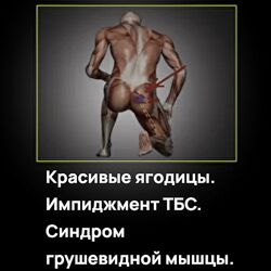 Александр Волоткевич Красивые ягодицы. Импиджмент ТБС. Синдром грушевидной
