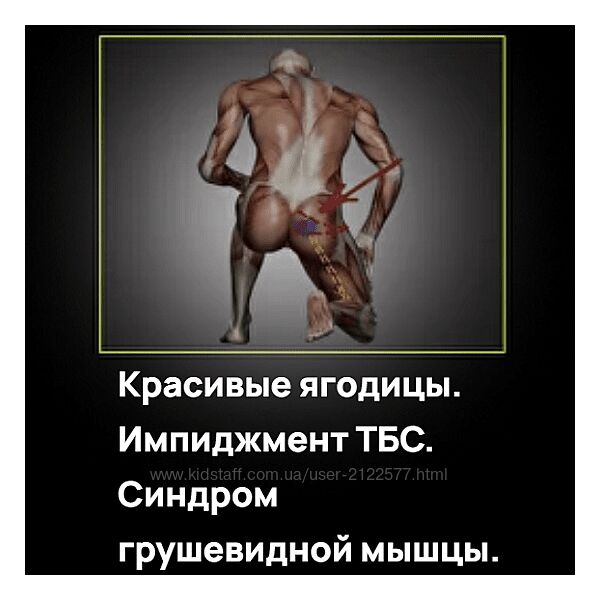 Александр Волоткевич Красивые ягодицы. Импиджмент ТБС. Синдром грушевидной