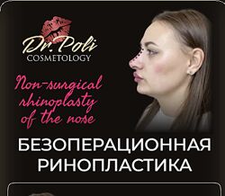 Безоперационная ринопластика 2025 Полина Еремина