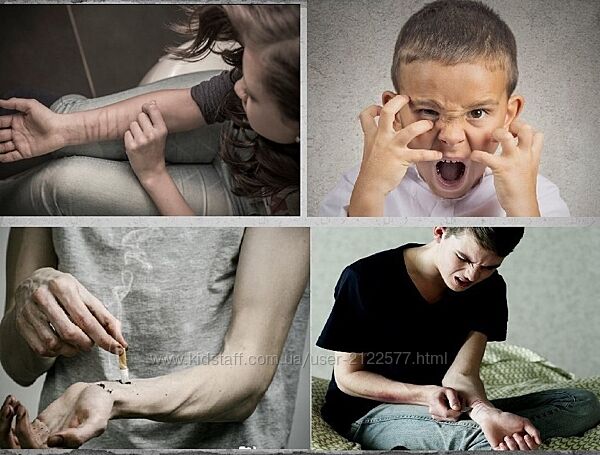 Надежда Десятник Применение терапии ЕМДР к самоповреждающему поведению 2025